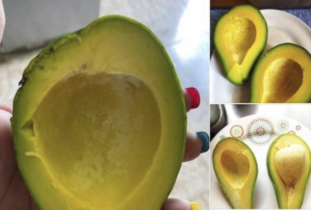 The Long-Term Impact of Avocados on Kidney Health: What You Need to Know