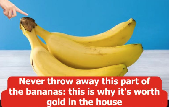Unlock the Hidden Value of Banana Peels: Why They’re a Treasure for Your Home